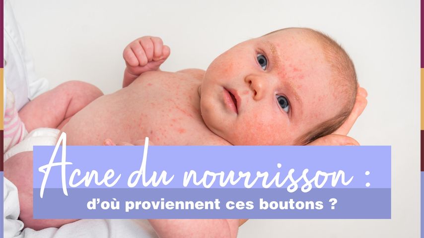 D Ou Viennent Ces Boutons D Acne Sur Le Corps De Bebe