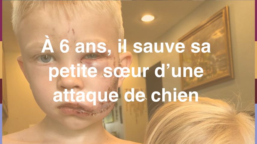 A 6 Ans Il Sauve Sa Petite Sœur D Une Attaque De Chien