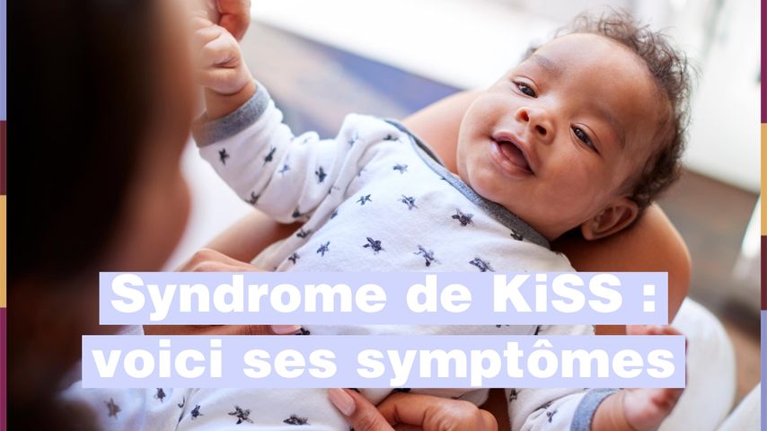 Syndrome De Kiss Comment Le Reconnaitre Chez Bebe