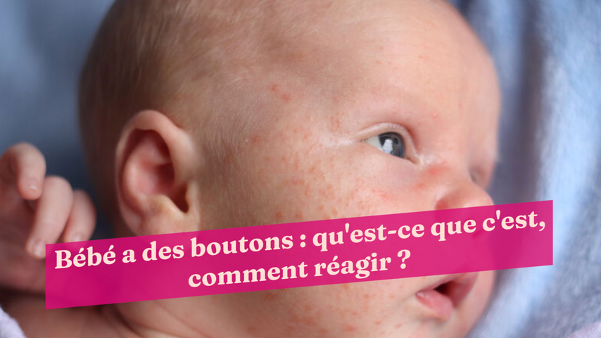Bébé a des boutons : qu'est-ce que c'est, comment réagir ?