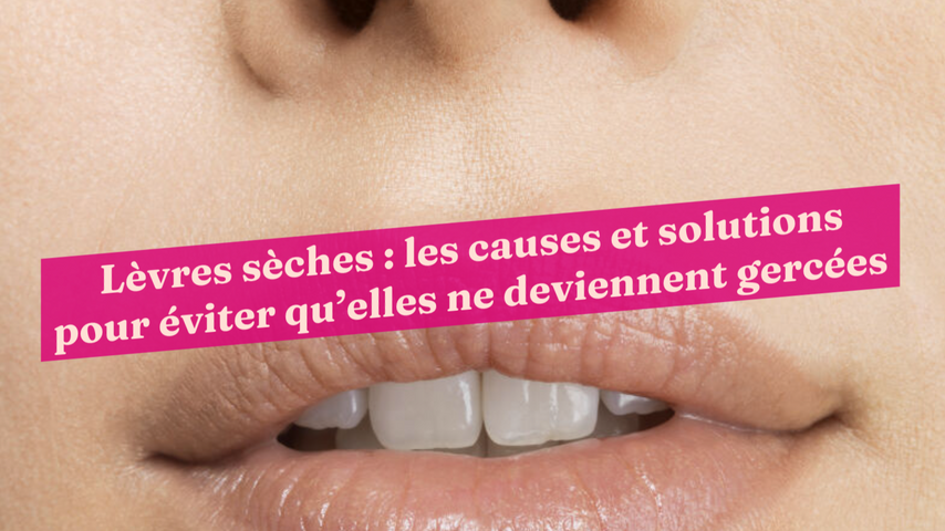 Lèvres sèches : les causes et solutions pour éviter qu’elles ne deviennent  gercées