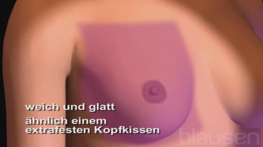 Brustkrebs Mammakarzinom Symptome Therapie Fruherkennung