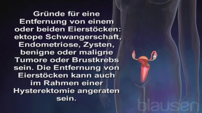 Eierstockzyste Symptome Ursachen Behandlung Onmeda De