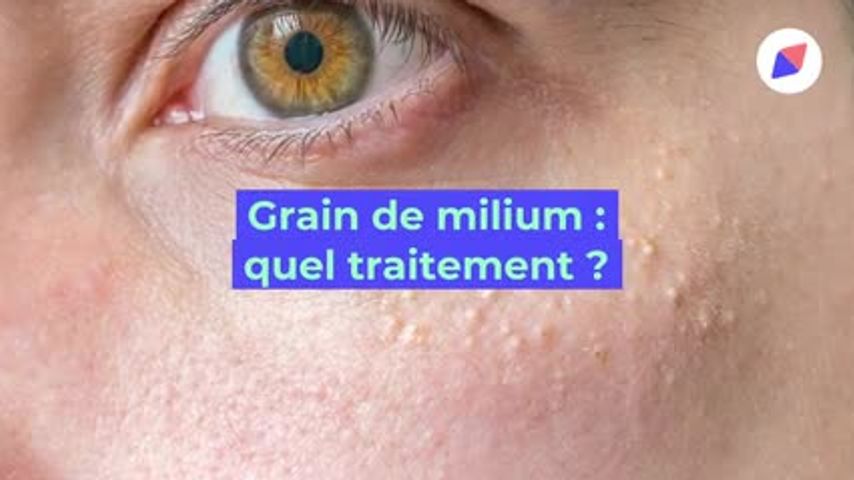 Grain De Milium Cause Et Traitement Des Grains De Milium Doctissimo